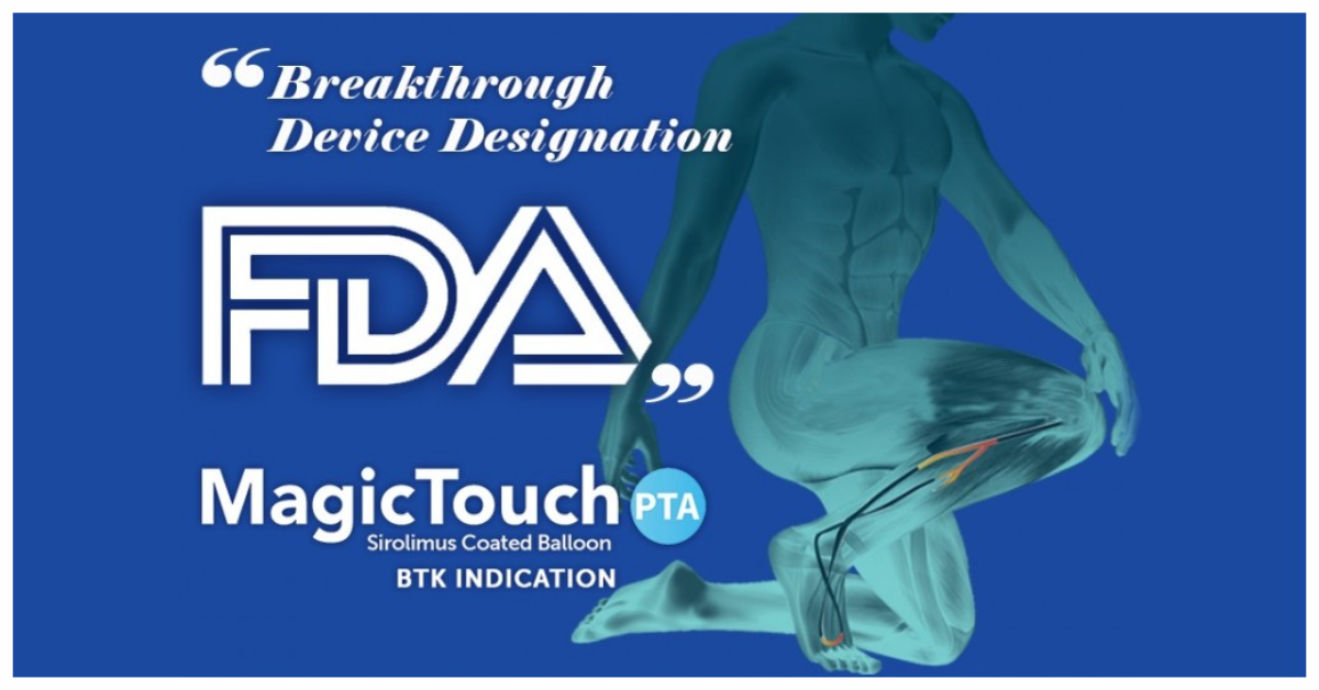 Concept Medical Granted “Breakthrough Device Designation” by FDA for MagicTouch PTA Sirolimus Coated Balloon