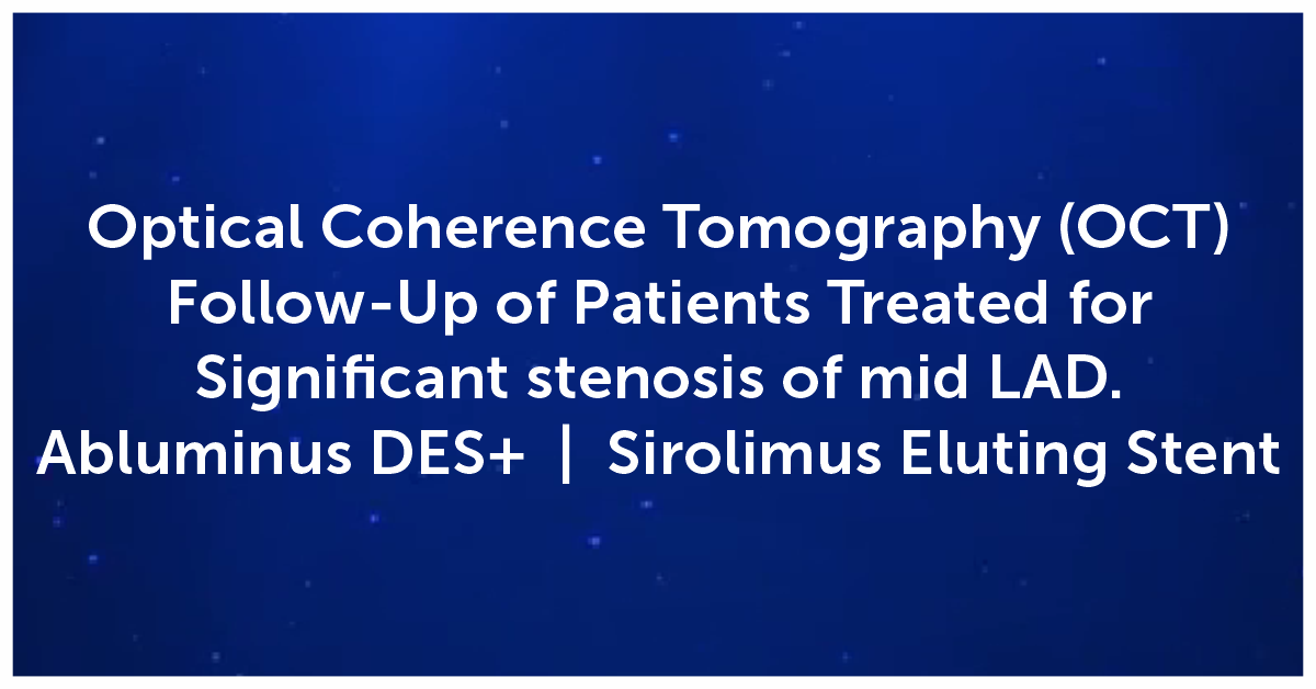 OCT Follow-Up of Patients Treated for Significant stenosis of mid LAD | Abluminus DES+ | Sirolimus Eluting Stent