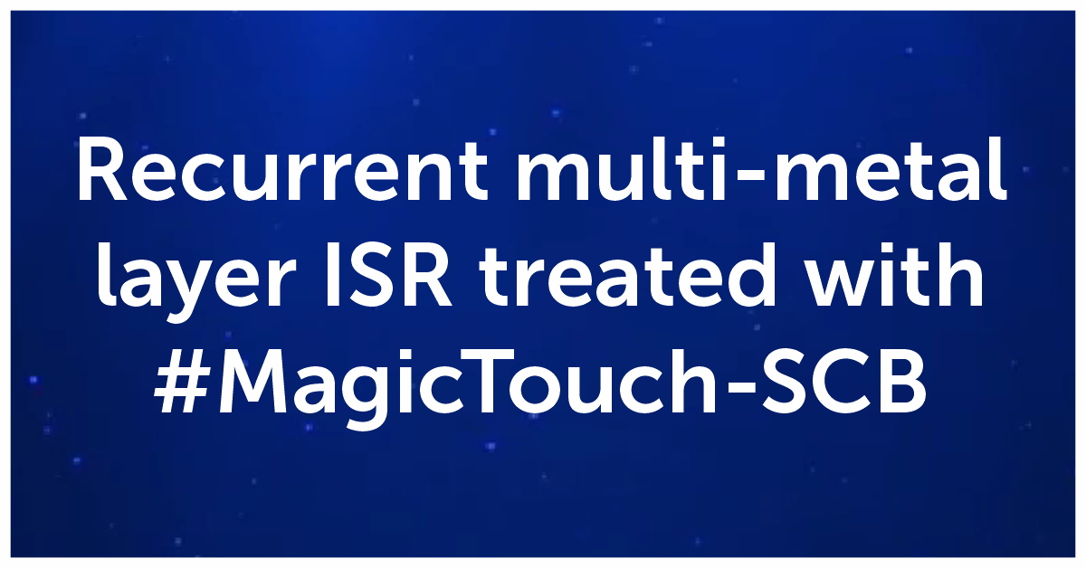 Recurrent multi-metal layer ISR treated with MagicTouch-SCB